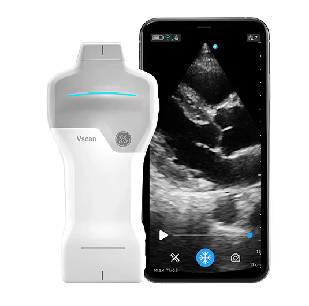 Vscan Air SL